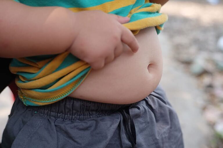 Obeziteti në Maqedoni, një krizë që rritet në heshtje